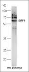 BRF1 RNA Polymerase III Transcription Initiation Factor Subunit antibody, orb158297, Biorbyt, Western Blot image 