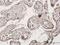 Zinc Finger Protein 584 antibody, H00201514-B01P, Novus Biologicals, Immunohistochemistry paraffin image 