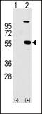 Aldehyde Dehydrogenase 1 Family Member A1 antibody, MBS9206935, MyBioSource, Western Blot image 