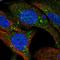 Transmembrane Protein 159 antibody, HPA063509, Atlas Antibodies, Immunofluorescence image 