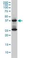 DnaJ Heat Shock Protein Family (Hsp40) Member B6 antibody, H00010049-M01, Novus Biologicals, Western Blot image 