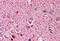 Neurofibromin 2 antibody, MBS240545, MyBioSource, Immunohistochemistry paraffin image 