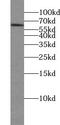Tetratricopeptide Repeat Domain 39B antibody, FNab09086, FineTest, Western Blot image 