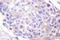 Ribosomal Protein S6 Kinase A1 antibody, LS-C176324, Lifespan Biosciences, Immunohistochemistry paraffin image 