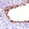 CD109 Molecule antibody, MA5-24208, Invitrogen Antibodies, Immunohistochemistry paraffin image 