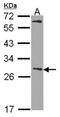 Glutathione S-Transferase Mu 1 antibody, NBP1-30876, Novus Biologicals, Western Blot image 