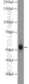 Deleted In Azoospermia 4 antibody, 14065-1-AP, Proteintech Group, Western Blot image 