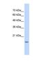 GABA Type A Receptor Associated Protein Like 1 antibody, NBP1-55203, Novus Biologicals, Western Blot image 