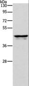 Apolipoprotein L1 antibody, LS-B15404, Lifespan Biosciences, Western Blot image 