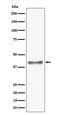 NK2 Homeobox 1 antibody, M01322-4, Boster Biological Technology, Western Blot image 