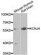 Potassium Voltage-Gated Channel Subfamily J Member 4 antibody, A06605-2, Boster Biological Technology, Western Blot image 