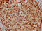 Lamin A/C antibody, CSB-PA013003HA01HU, Cusabio, Immunohistochemistry paraffin image 