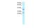 Sirtuin 5 antibody, GTX77826, GeneTex, Western Blot image 