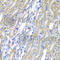 Cytochrome P450 Family 20 Subfamily A Member 1 antibody, A6476, ABclonal Technology, Immunohistochemistry paraffin image 