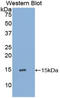 Interleukin 15 antibody, LS-C294838, Lifespan Biosciences, Western Blot image 