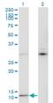 C-X9-C Motif Containing 4 antibody, H00004515-M05, Novus Biologicals, Western Blot image 