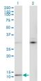 C-X9-C Motif Containing 4 antibody, H00004515-M05, Novus Biologicals, Western Blot image 