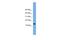 LSM8 Homolog, U6 Small Nuclear RNA Associated antibody, A12311, Boster Biological Technology, Western Blot image 