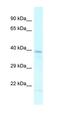 LIM Homeobox 2 antibody, orb329989, Biorbyt, Western Blot image 