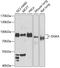 Diacylglycerol Kinase Alpha antibody, 15-299, ProSci, Western Blot image 