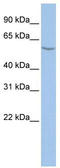 Asparagine-linked glycosylation protein 11 homolog antibody, TA335311, Origene, Western Blot image 