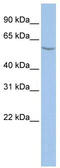 ALG11 Alpha-1,2-Mannosyltransferase antibody, TA335311, Origene, Western Blot image 