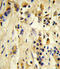 Eukaryotic Translation Initiation Factor 4E Family Member 2 antibody, abx031084, Abbexa, Western Blot image 