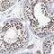 Calcium Binding And Coiled-Coil Domain 2 antibody, NBP1-87874, Novus Biologicals, Immunohistochemistry paraffin image 