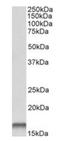 Cystatin B antibody, orb18776, Biorbyt, Western Blot image 