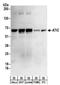 5-Aminoimidazole-4-Carboxamide Ribonucleotide Formyltransferase/IMP Cyclohydrolase antibody, NBP2-32183, Novus Biologicals, Western Blot image 