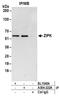 Death-associated protein kinase 3 antibody, A304-222A, Bethyl Labs, Immunoprecipitation image 