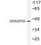 Golgi reassembly-stacking protein 2 antibody, LS-C177457, Lifespan Biosciences, Western Blot image 