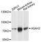 N-Acylsphingosine Amidohydrolase 2 antibody, A12596, ABclonal Technology, Western Blot image 