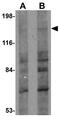 FERM And PDZ Domain Containing 1 antibody, GTX85011, GeneTex, Western Blot image 