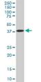 Choline-phosphate cytidylyltransferase A antibody, H00005130-M02, Novus Biologicals, Western Blot image 