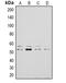LYN Proto-Oncogene, Src Family Tyrosine Kinase antibody, LS-C368649, Lifespan Biosciences, Western Blot image 