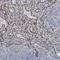 KN Motif And Ankyrin Repeat Domains 3 antibody, HPA051153, Atlas Antibodies, Immunohistochemistry paraffin image 