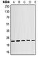 Crystallin Alpha B antibody, orb213783, Biorbyt, Western Blot image 