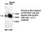 AKT Serine/Threonine Kinase 2 antibody, MBS415443, MyBioSource, Western Blot image 