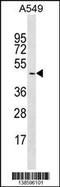 Glycogenin 2 antibody, 59-889, ProSci, Western Blot image 