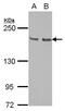 Kinesin-like protein KIF14 antibody, PA5-27859, Invitrogen Antibodies, Western Blot image 