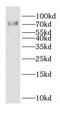 Denticleless E3 Ubiquitin Protein Ligase Homolog antibody, FNab02549, FineTest, Western Blot image 