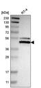 Nuclear factor 1 X-type antibody, PA5-64917, Invitrogen Antibodies, Western Blot image 