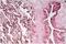 Carcinoembryonic Antigen Related Cell Adhesion Molecule 6 antibody, NBP2-54626, Novus Biologicals, Immunohistochemistry frozen image 
