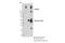 Glutamate Metabotropic Receptor 5 antibody, 55920S, Cell Signaling Technology, Immunoprecipitation image 