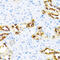 Kallikrein Related Peptidase 11 antibody, abx006376, Abbexa, Western Blot image 