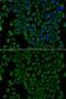 Transcobalamin 2 antibody, GTX16437, GeneTex, Immunofluorescence image 