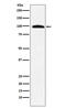 Transportin 3 antibody, M03407-1, Boster Biological Technology, Western Blot image 
