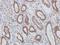 Mucin 1, Cell Surface Associated antibody, orb315622, Biorbyt, Immunohistochemistry paraffin image 