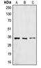 ZFP36 Ring Finger Protein Like 1 antibody, LS-B13593, Lifespan Biosciences, Western Blot image 
